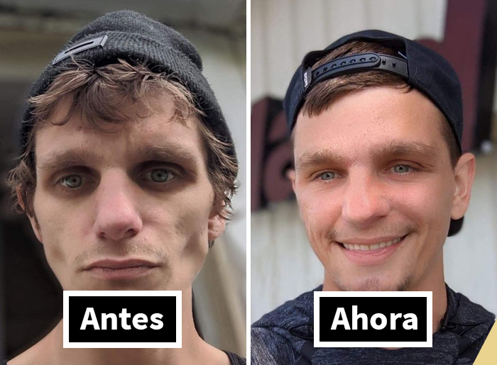 “Diario de un adicto”: 20 impactantes transformaciones de gente que solía ser adicta a las drogas (Nuevas historias)