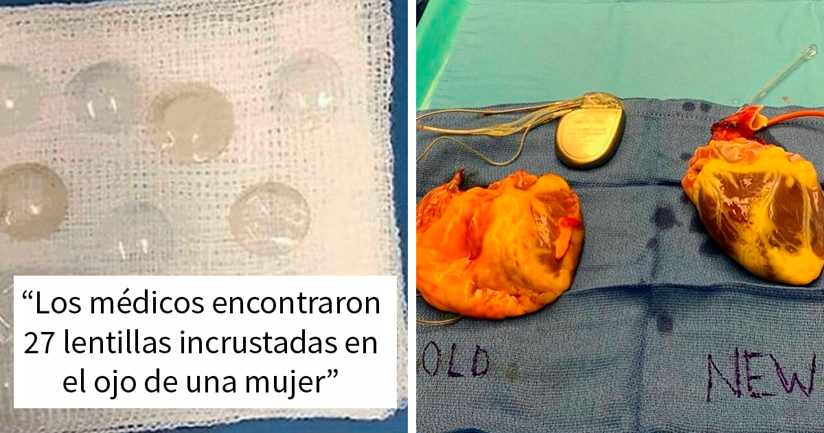 35 Increíbles casos médicos tan interesantes como extravagantes