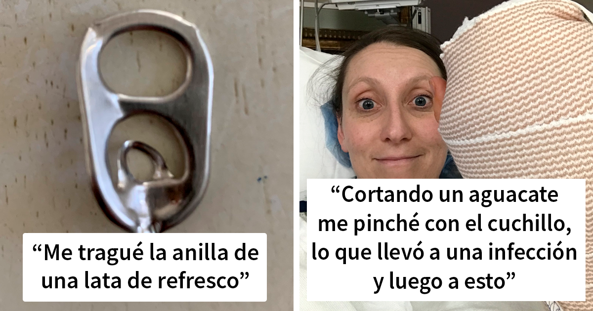 20 Personas que se lesionaron de forma estúpida, y tenían que advertir a los demás