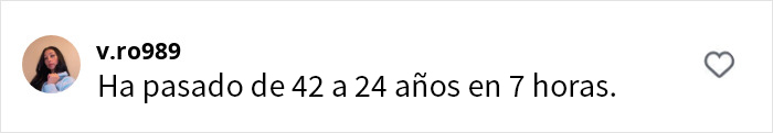 Se vuelven virales los resultados de la cirugía plástica de este paciente, que se ha quitado décadas de encima