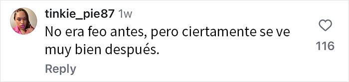 Se vuelven virales los resultados de la cirugía plástica de este paciente, que se ha quitado décadas de encima